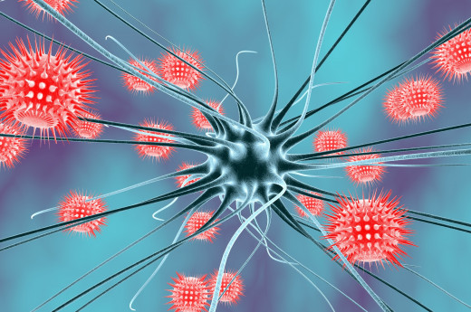 brain cells affected by encephalitis